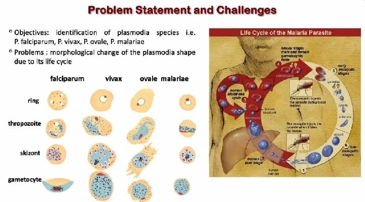 BRIN Kembangkan Sistem Diagnosis Malaria Berbasis Kecerdasan Buatan
